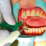 Immagine di collaborazione tra il reparto di Igiene Dentale e i reparti di Ginecologia e Pediatria.  Foto estratte da Baldoni M, Panzeri MC et al. “Manuale operativo per igienisti dentali.” Ariedue srl, 2022. 160-316.