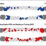 Fig. 1 Nella foto un esempio di dati forniti dagli strumenti in dotazione agli igienisti dentali (https://periodontalchart-online.com/it/).