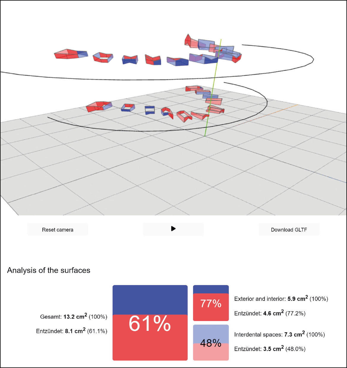 Fig. 3 Nella foto un esempio di dati forniti dagli strumenti in dotazione agli igienisti dentali (https://periodontalchart-online.com/it/).