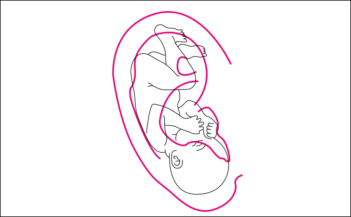 Fig. 2 Mappa Nogier.