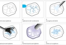 Applicazione per step