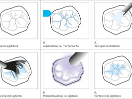 Applicazione per step