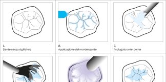Materiali da sigillatura, quali scegliere? Applicazione per step