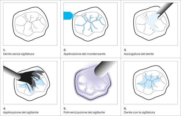 Applicazione per step
