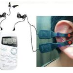 Fig. 6C Stimolazione auricolare con T.E.N.S.