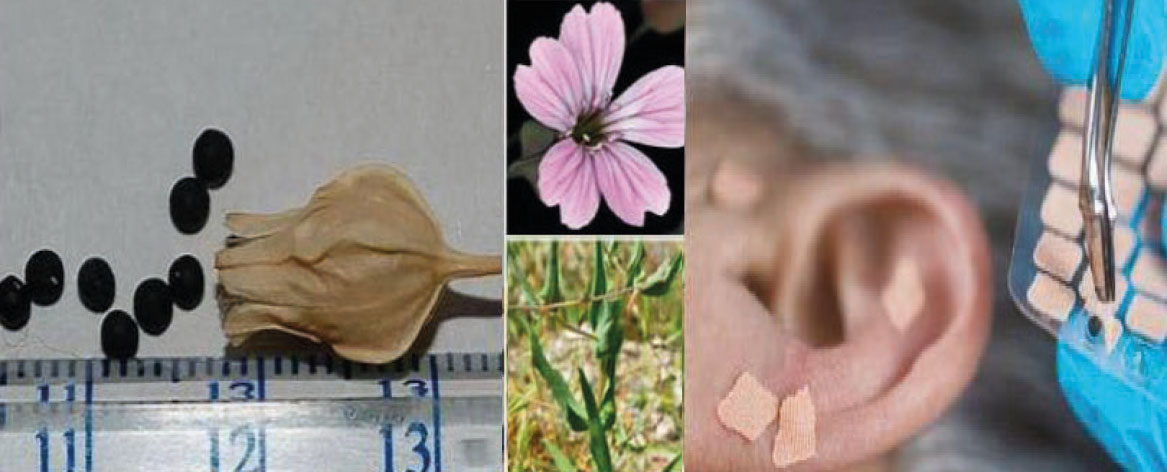 Fig. 7A Metodi di stimolazione auricolare con semi di vaccaria.