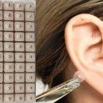 Fig. 7B Metodi di stimolazione auricolare con sferette magnetiche.