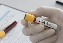 sub commissari psa