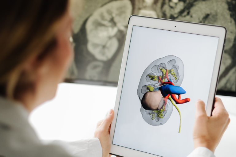 Diagnostica 3D per il tumore del rene