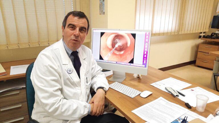 Al Policlinico Gemelli crioablazione per trattare l’esofago di Barrett