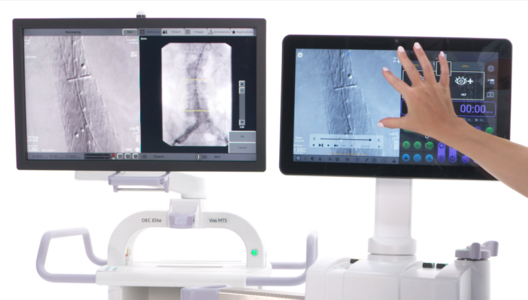 Gestione della dose radiogena, procedure più sicure per pazienti e operatori con gli Archi a C di GE HealthCare
