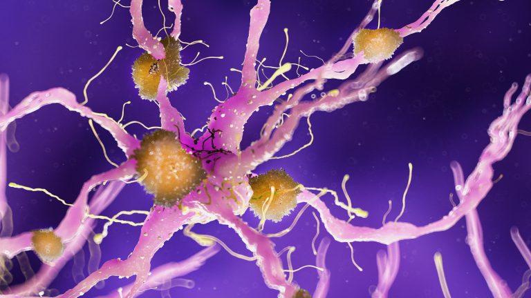 Alzheimer e neuroscienze, nasce nuovo Intergruppo Parlamentare