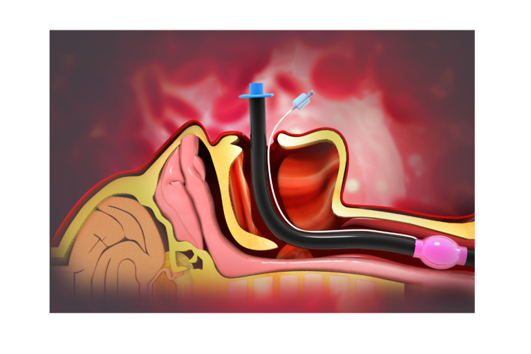 <strong>Intubazione, videolaringoscopio sicuro anche su paziente critico</strong>
