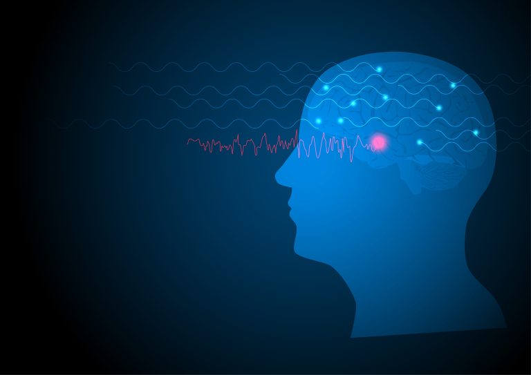 Epilessie rare, rivedere i PDTA per migliorare la vita di qualità