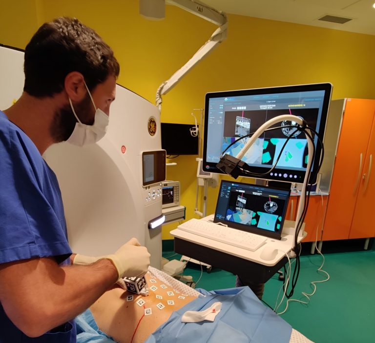 Realtà aumentata per facilitare le biopsie ossee