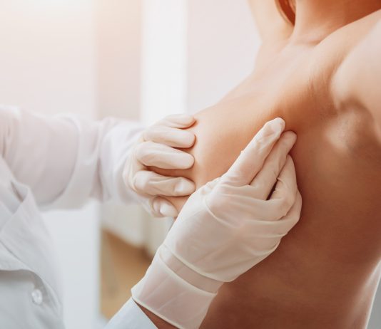 Breast coNnEcTion, percorso senologico integrato ospedale-territorio