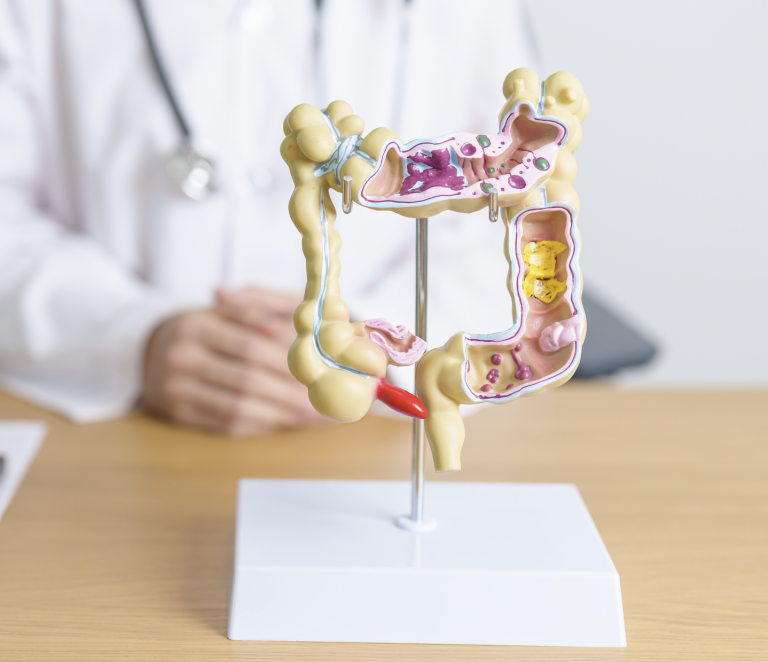 Tumore del colon-retto, screening più efficace del previsto