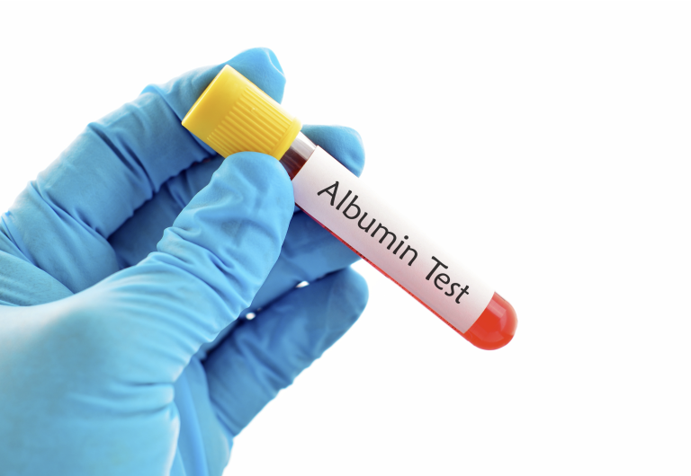 Cancro e infarto nell’anziano: una proteina potrebbe predirli