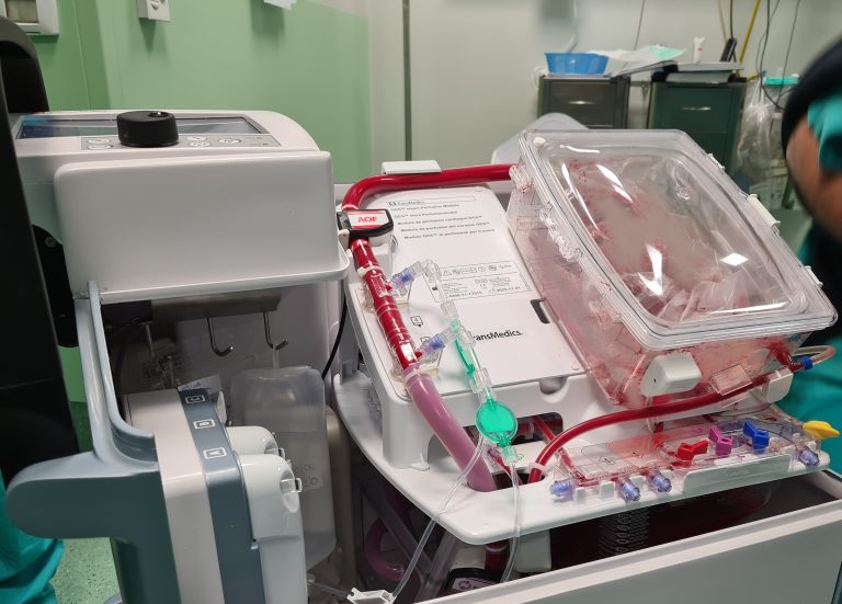 Trapianto, un sistema portatile di perfusione cardiaca