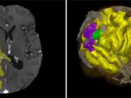 Il Politecnico di Milano lancia il primo applicativo IA per la cura del singolo organo
