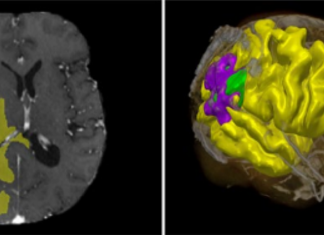 Il Politecnico di Milano lancia il primo applicativo IA per la cura del singolo organo