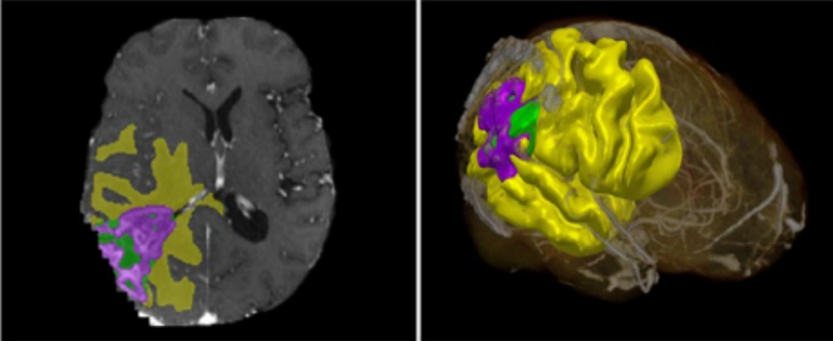 Il Politecnico di Milano lancia il primo applicativo IA per la cura del singolo organo