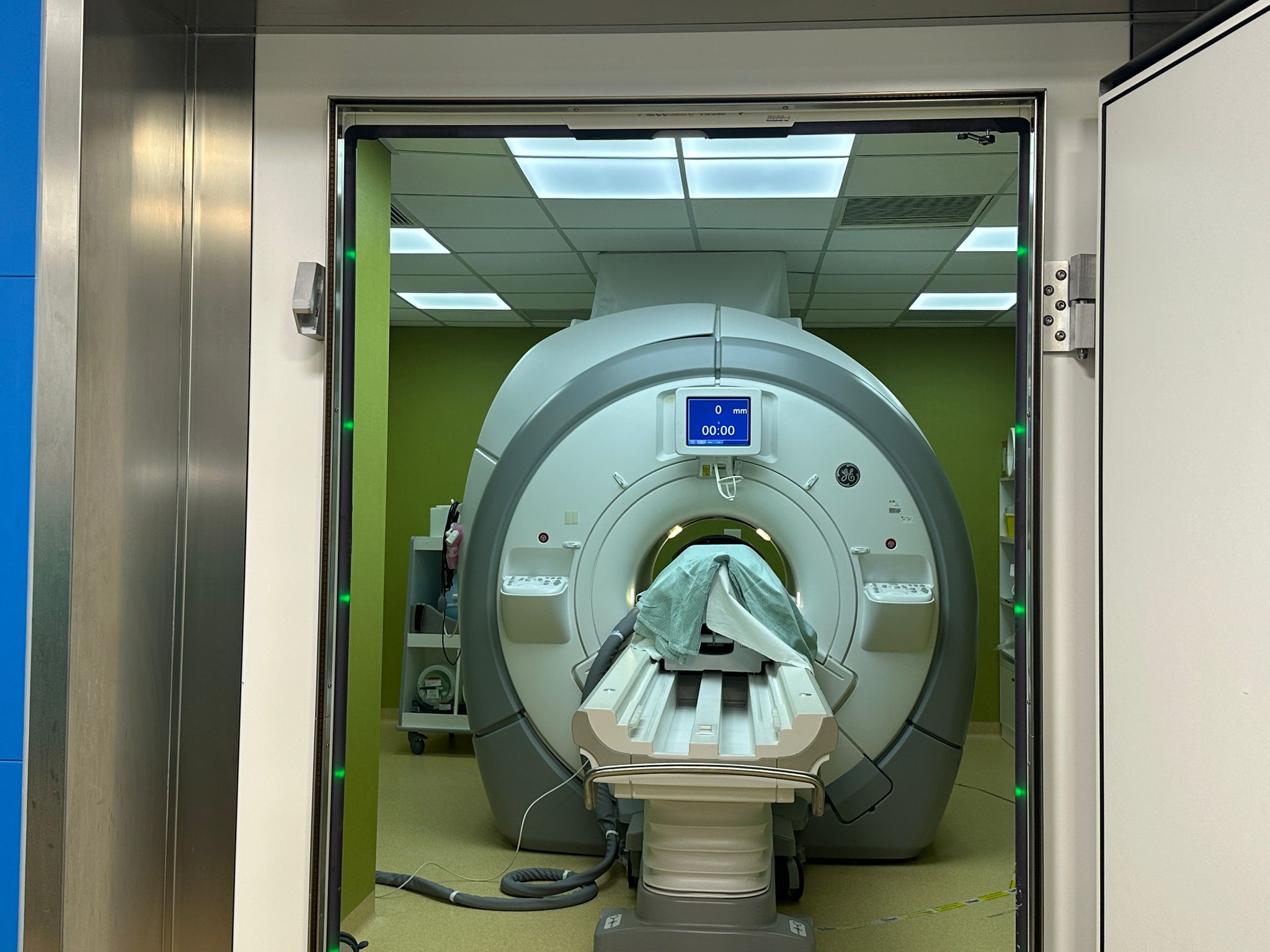 Irccs Besta, ultrasuoni focalizzati guidati da RM trattano tremori e tumori cerebrali