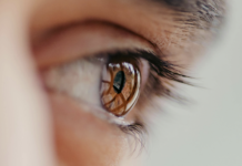 Irccs Bietti impianto endotelio artificiale