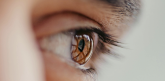 Irccs Bietti impianto endotelio artificiale