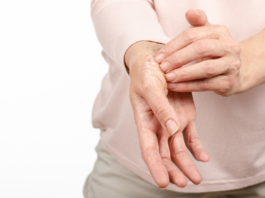 (H) Open day sulla psoriasi