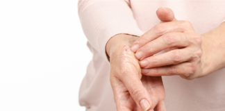 (H) Open day sulla psoriasi