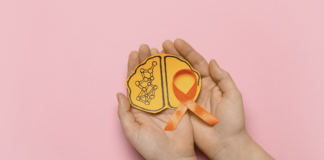 sclerosi multipla e radiofrequenza pulsata