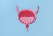 Carcinoma uroteliale, dispositivo per rilascio costante di chemioterapico carcinoma uroteliale