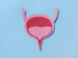 Carcinoma uroteliale, dispositivo per rilascio costante di chemioterapico carcinoma uroteliale