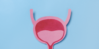 carcinoma uroteliale