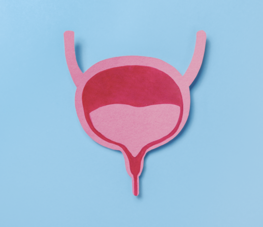 carcinoma uroteliale